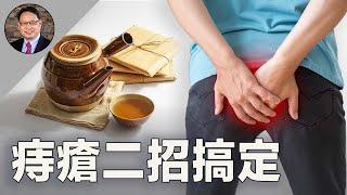 痔瘡反反覆覆？中醫調理助你徹底擺脫痛苦！