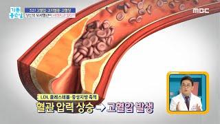 [기분 좋은 날] 모세혈관이 사라지는 원인?, MBC 211013 방송