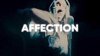 [FREE] Polo G Type Beat x Lil Tjay Type Beat - "Affection"