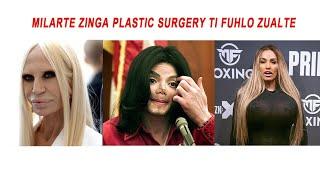 Celebrity zinga  Plastic Surgery ti fuhlo zualte