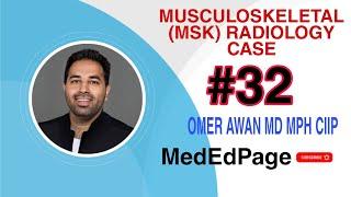Musculoskeletal (MSK) Radiology CASE #32
