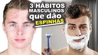 3 HÁBITOS MASCULINO que dão MUITAS espinhas