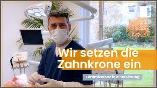 Zahnkrone einsetzen Ablauf: Krone in einer Sitzung mit CEREC | Carree Dental Köln