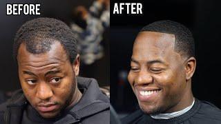 HOW TO FIX A RECEDING HAIRLINE