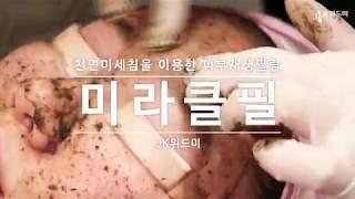 미라클필) 천연미세침을 이용한 피부재생필링