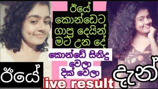 පිස්සුවෙන් වගේ කොන්ඩේ වැවෙන අපූරු රහස / How to grow hair fast sinhala / konde wawena beheth /kondeta