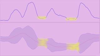 (ZIM) International Shipping Stock Chart Analysis With The Bollinger Bands Width Indicator