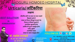 Skin Solutions: Urticaria, Allergy, Hives, Warts Cure by Dr. Sahadeo Wankhade Akola"