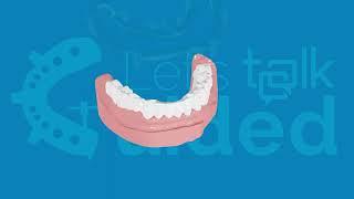 Mandibular guide AOX