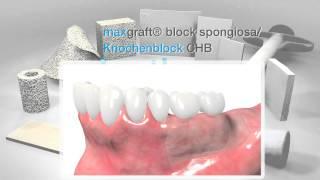 botiss biomaterials Portfolio (March 2015)