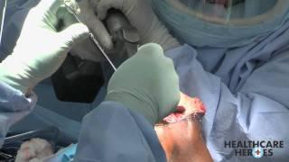 Knee Replacement Surgery