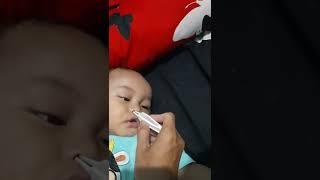 Alat Untuk Mengambil Upil Bayi