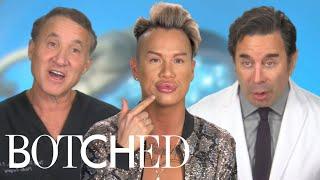 Overfilled & Unemployed: Jonathan’s Lip Filler FAIL | Botched | E!