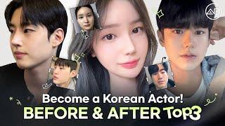 Top 3 Incredible Transformations That Will Inspire You! | AB Plastic Surgery Korea