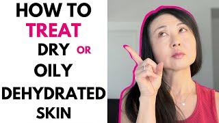 How To Treat Dry AND DEHYDRATED Skin or OILY DEHYDRATED SKIN  #goseechristydryvsdehydratedskin