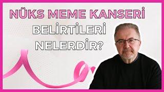 Nüks Meme Kanserinin Belirtileri Nelerdir?