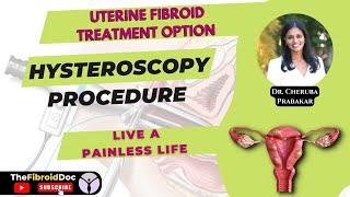 Hysteroscopy Procedure || Uterine Fibroid Treatment Option || Live A Painless Life || TheFibroidDoc.