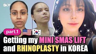 Part 1) My facelift experience in Korea