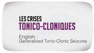 Generalized Tonic Clonic Seizures