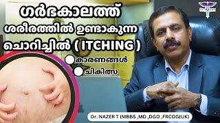 PREGNANCY ITCHING MALAYALAM | ഗർഭകാലത്ത് ശരീരത്തിൽ ഉണ്ടാകുന്ന ചൊറിച്ചിൽ | TREATMENT | Dr NAZER