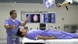 Image Guided Surgery for Brain Tumors copy