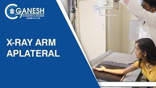 X-Ray Arm AP/Lateral | Ganesh Diagnostic & Imaging Center