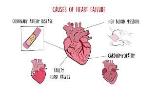 World Heart Federation Roadmap on Heart Failure