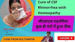 Cure of CSF Rhinorrhea within a few hours from Homeopathy  Dr Ravi Singh