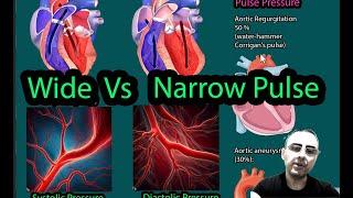 Narrow pulse pressure vs Wide Pulse pressure