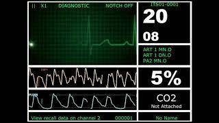 Hospital Monitor with FlatLine (S) (HD)