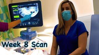 8 Week Scan & no heartbeat | What to expect with Silent/missed miscarriage & early symptoms Vlog 13