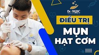 Đốt hạt cơm bằng laser_ Điều trị mụn hạt cơm