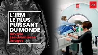 [Première mondiale] Le cerveau dévoilé comme jamais grâce à l’IRM le plus puissant au monde