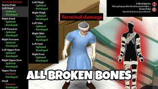 All My Bones are Broken | Project Zomboid