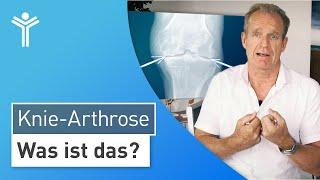 Knie-Arthrose: Was ist die Arthrose des Kniegelenks und wie kommt es zum Gelenkverschleiß?