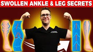 Lymphedema Treatment [How to Get Rid of Swollen Feet, Ankles & Legs]