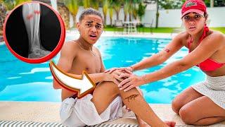 RYAN MACHUCOU O PÉ FEIO NA PISCINA E TEVE QUE IR PRO HOSPITAL 