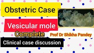 Obstetric case discussion on  Gestational Trophoblastic disease @saisamarthgyneclasses