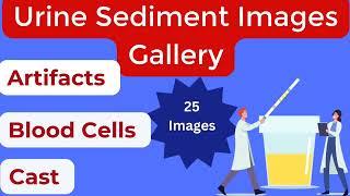 Urine Sediments Images #Urine Microscopy @mlteducareer_bakhtawar