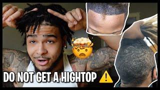 WATCH THIS BEFORE GETTING HIGHTOP LOCS ‼️ ARE HIGHTOPS LOCS BETTER THAN A FULL HEAD ⁉️