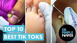 Dr Pimple Popper's Top 10 Best TikToks!