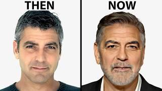 George Clooney's NEW FACE | Plastic Surgery Analysis