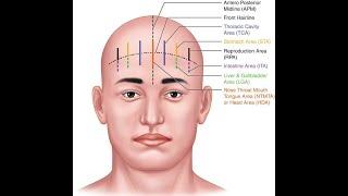 SCALP ACUPUNCTURE: Principles of Point Selection, Indications