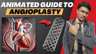 Step-by-Step Guide to Angioplasty: How This Life-Saving Procedure Restores Blood Flow