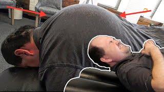 Man CAN'T Move His NECK & Has SEVERE HYPERKYPHOSIS! *Part 2*