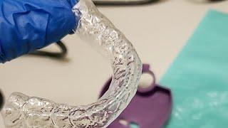 How to make clear retainers