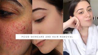 My PCOD Skincare | How I Got Rid of Acne & Facial Hair