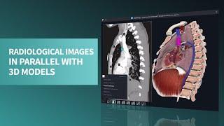 View radiological images in parallel with 3D models