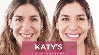 Katy's Porcelain Veneers Smile Makeover Journey | Dental Boutique
