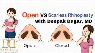 What is a Closed Rhinoplasty "Scarless Nose" vs Open Rhinoplasty? by Dr. Deepak Dugar, Beverly Hills